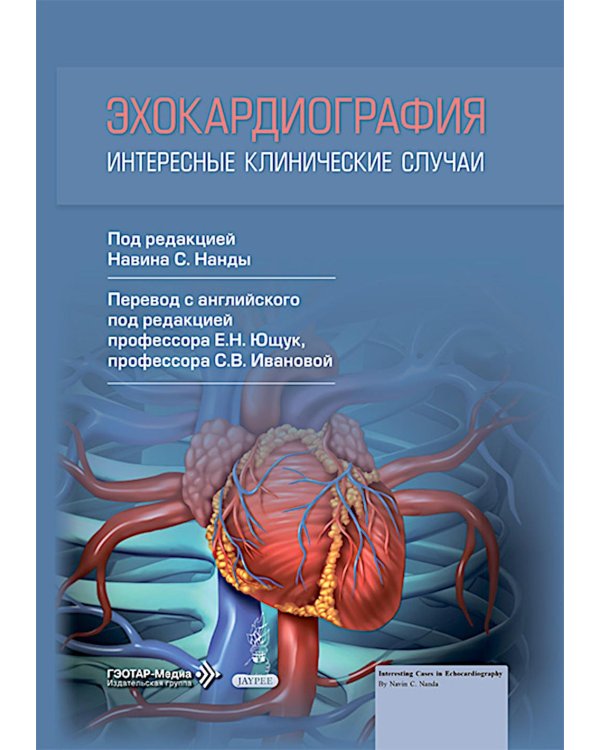 Эхокардиография. Интересные клинические случаи