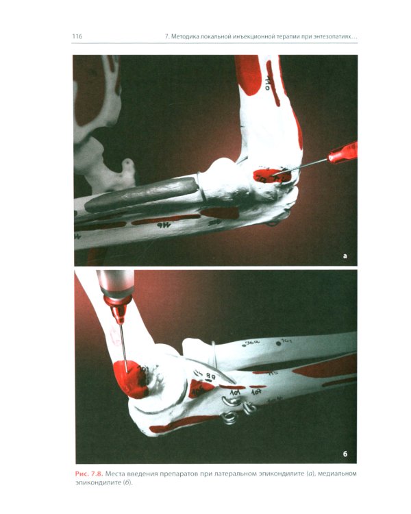 Локальная инъекционная терапия при повреждениях и заболеваниях опорно-двигательной системы. 5-е изд