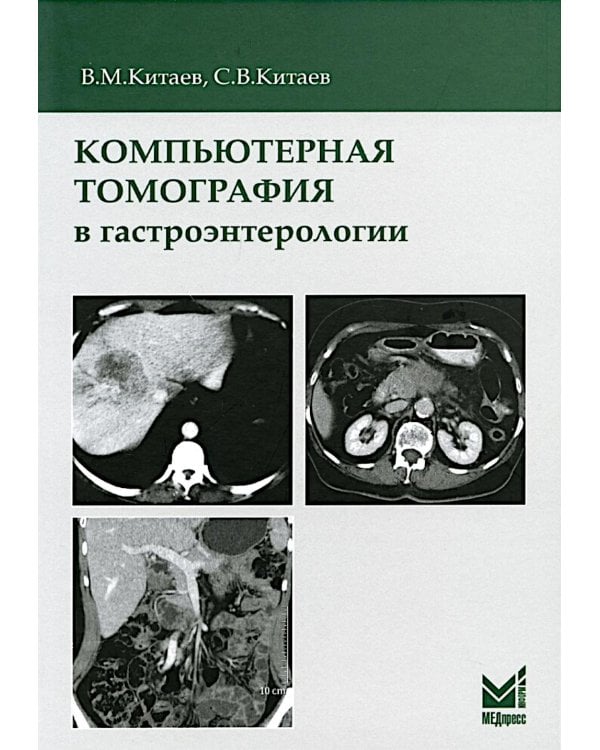 Компьютерная томография в гастроэнтерологии: руководство для врачей. 3-е изд., испр.и доп