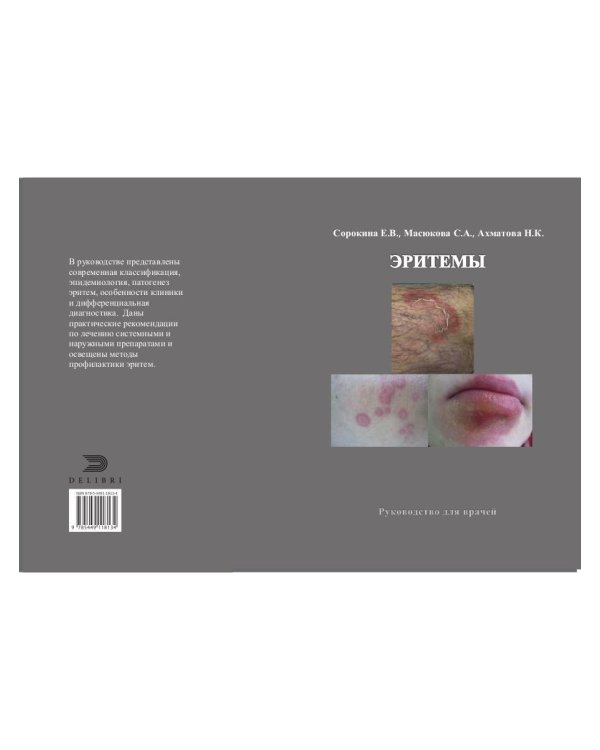 Эритемы. Руководство для врачей
