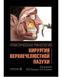 Практическая ринология: хирургия верхнечелюстной пазухи