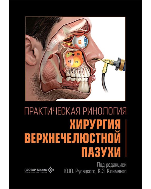 Практическая ринология: хирургия верхнечелюстной пазухи