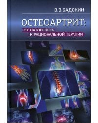 Остеоартрит: от патогенеза к рациональной терапии
