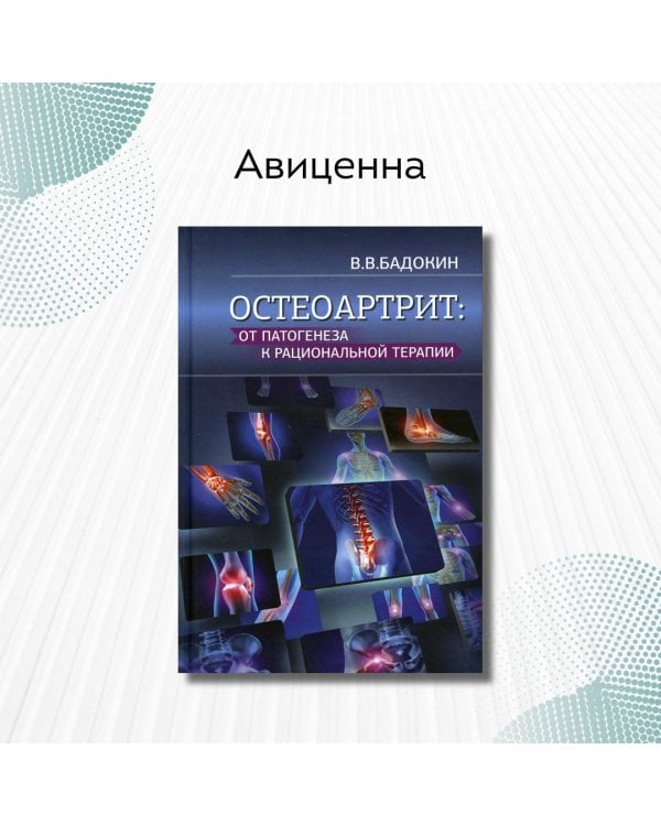 Дополнительное изображение книги «Остеоартрит: от патогенеза к рациональной терапии»