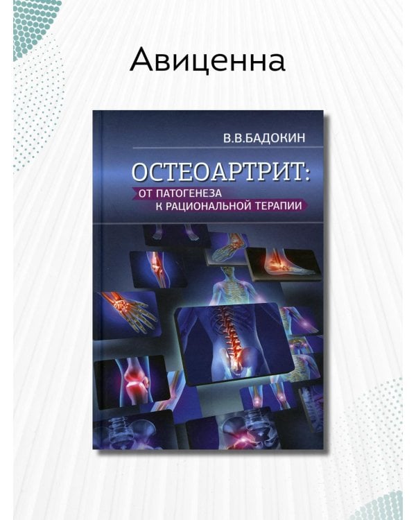 Дополнительное изображение книги «Остеоартрит: от патогенеза к рациональной терапии»