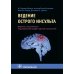 Ведение острого инсульта
