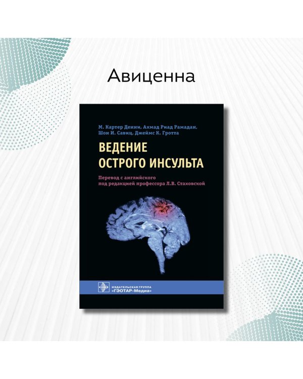 Ведение острого инсульта
