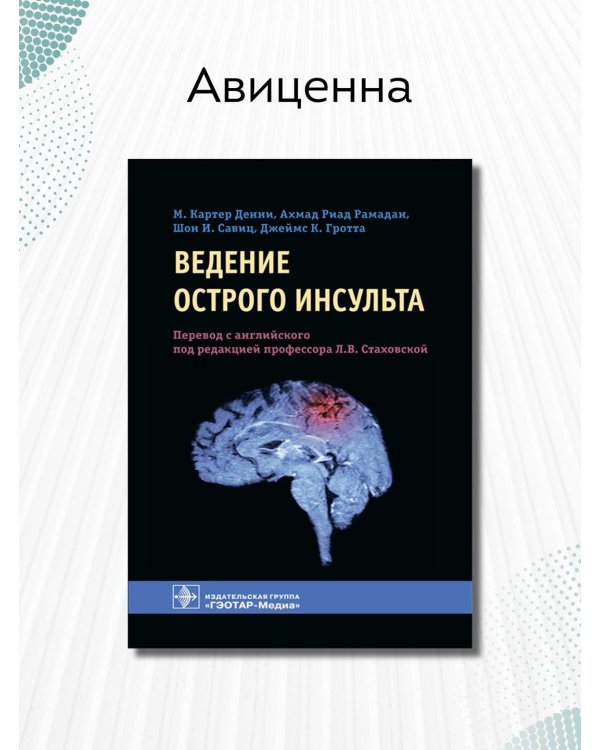 Ведение острого инсульта