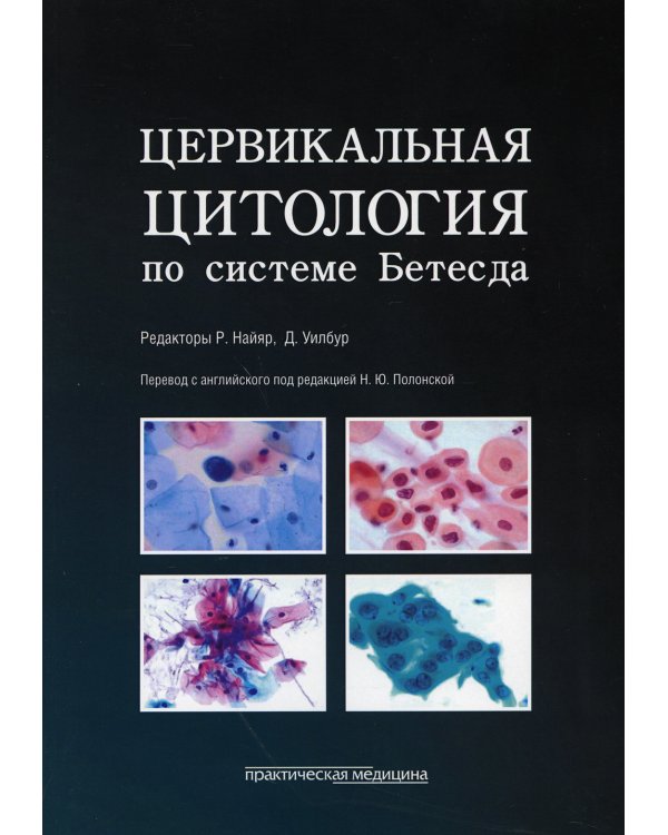 Цервикальная цитология по системе Бетесда. Терминология, критерии и пояснения