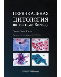 Цервикальная цитология по системе Бетесда. Терминология, критерии и пояснения