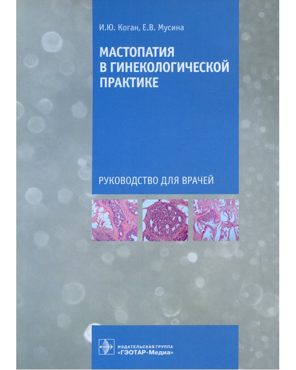 Мастопатия в гинекологической практике: руководство для врачей