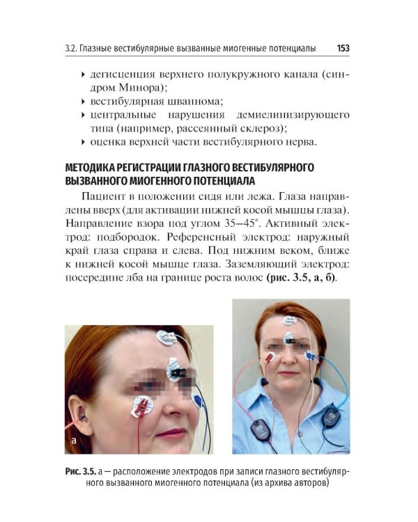 Объективные методы диагностики слуха: вызванные потенциалы в практике врача - сурдолога-оториноларинголога