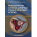 Микрохирургия сложных аневризм средних мозговых артерий: гигантских, фузиформных и частично тромбированных
