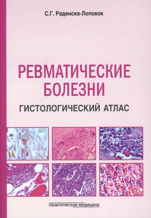 Ревматические болезни. Гистологический атлас