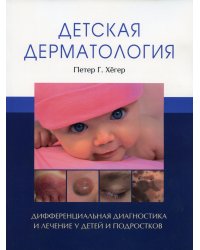 Детская дерматология. (обл.) Дифференциальная диагностика и лечение у детей и подростков