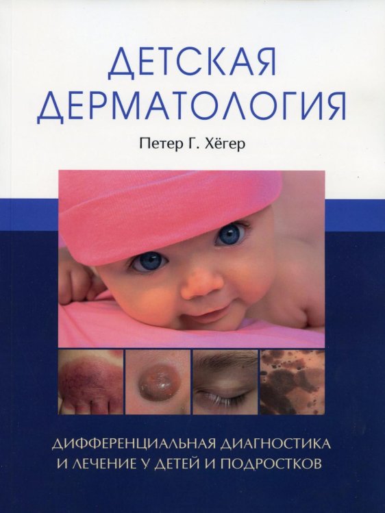 Детская дерматология. (обл.) Дифференциальная диагностика и лечение у детей и подростков Детская дерматология. (обл.) Дифференциальная диагностика и лечение у детей и подростков