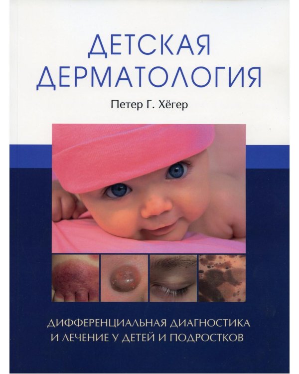 Детская дерматология. (обл.) Дифференциальная диагностика и лечение у детей и подростков