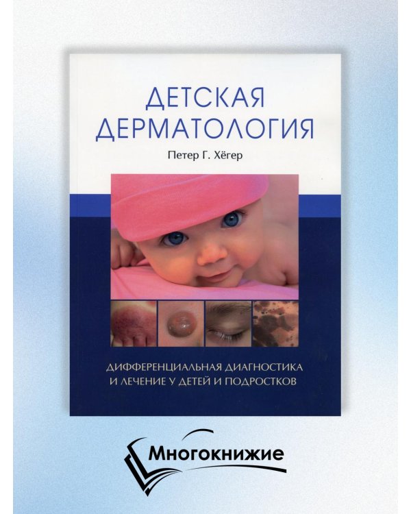 Детская дерматология