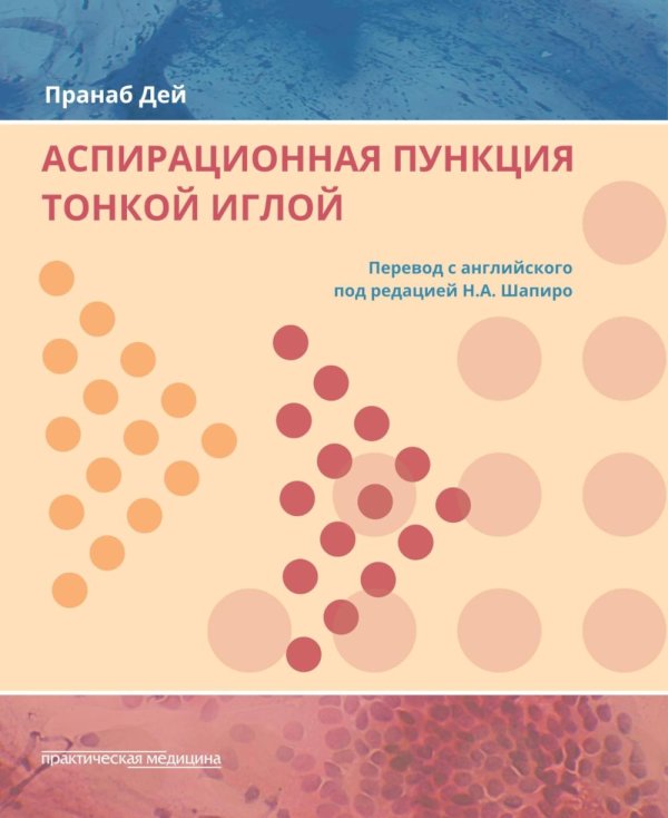 Аспирационная пункция тонкой иглой. Трактовка результатов и диагностические проблемы