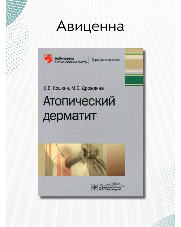 Атопический дерматит