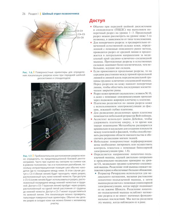 Хирургия позвоночника: иллюстрированные советы и практические рекомендации