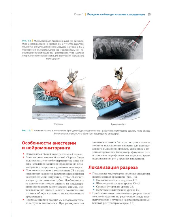 Хирургия позвоночника: иллюстрированные советы и практические рекомендации