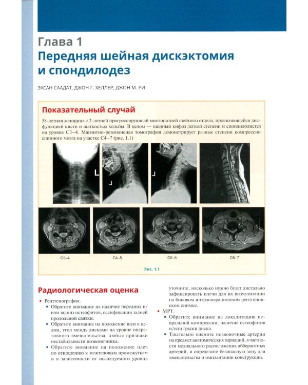 Хирургия позвоночника: иллюстрированные советы и практические рекомендации