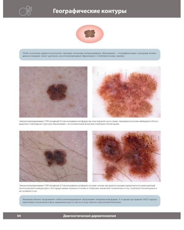Диагностическая дерматоскопия: иллюстрированное руководство. 2-е изд