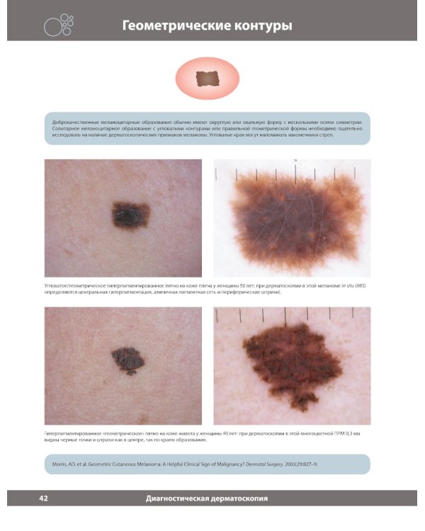 Диагностическая дерматоскопия: иллюстрированное руководство. 2-е изд