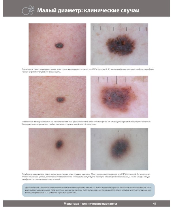 Диагностическая дерматоскопия: иллюстрированное руководство. 2-е изд