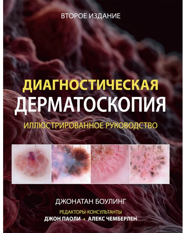 Диагностическая дерматоскопия: иллюстрированное руководство. 2-е изд