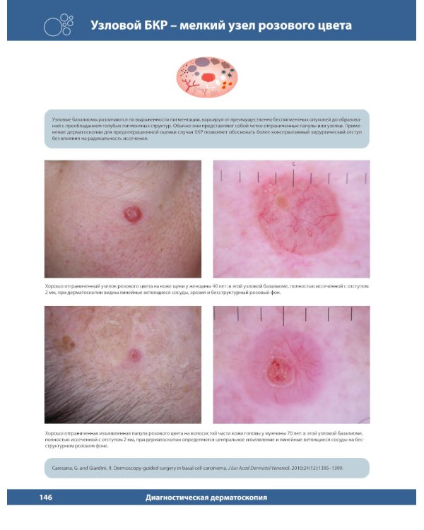 Диагностическая дерматоскопия: иллюстрированное руководство. 2-е изд