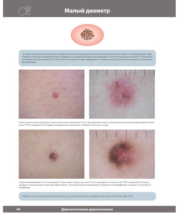 Диагностическая дерматоскопия: иллюстрированное руководство. 2-е изд