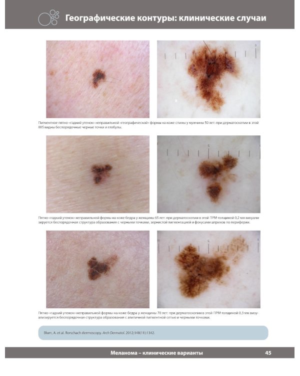 Диагностическая дерматоскопия: иллюстрированное руководство. 2-е изд
