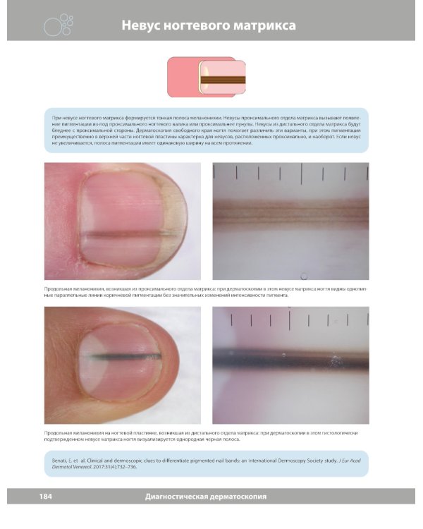 Диагностическая дерматоскопия: иллюстрированное руководство. 2-е изд