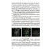 Нейровизуализация при энцефалитах и менингитах у детей Нейровизуализация при энцефалитах и менингитах у детей
