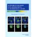 Нейровизуализация при энцефалитах и менингитах у детей Нейровизуализация при энцефалитах и менингитах у детей