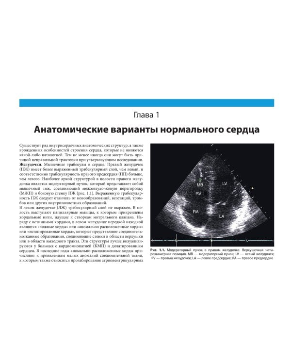 Клиническая эхокардиография: практическое руководство