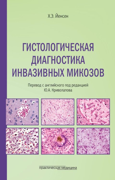 Гистологическая диагностика инвазивных микозов