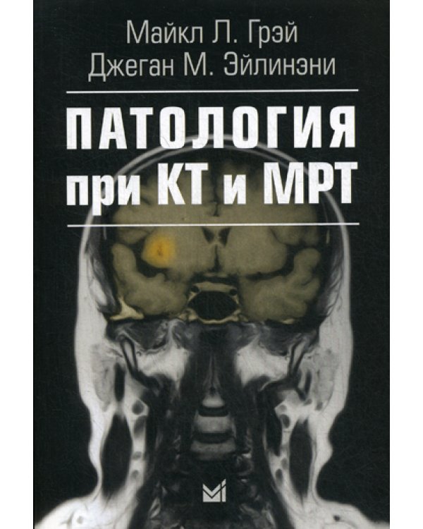 Патология при КТ и МРТ. 2-е изд