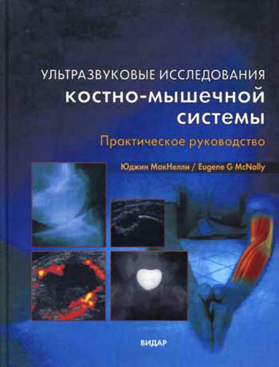 Ультразвуковые исследования костно-мышечной системы. Практическое руководство