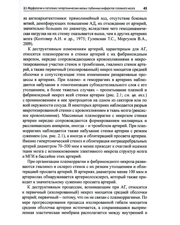 Малые инфаркты головного мозга