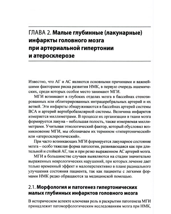 Малые инфаркты головного мозга