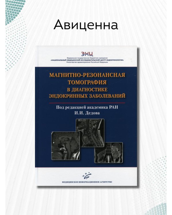 Магнитно-резонансная томография в диагностике эндокринных заболеваний