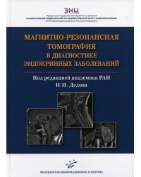 Магнитно-резонансная томография в диагностике эндокринных заболеваний