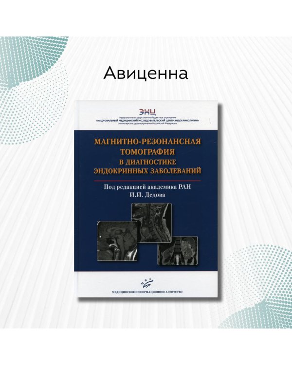 Магнитно-резонансная томография в диагностике эндокринных заболеваний