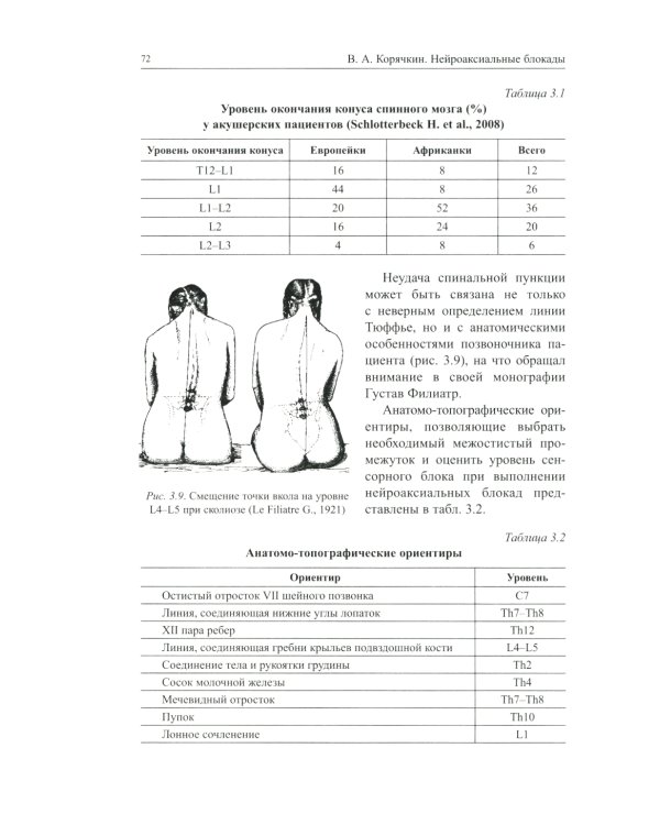 Нейроаксиальные блокады. 3-е изд