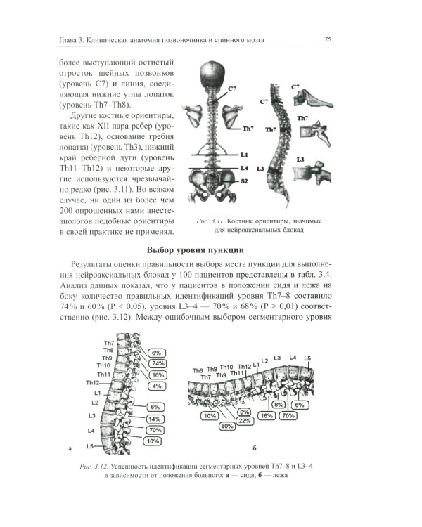 Нейроаксиальные блокады. 3-е изд