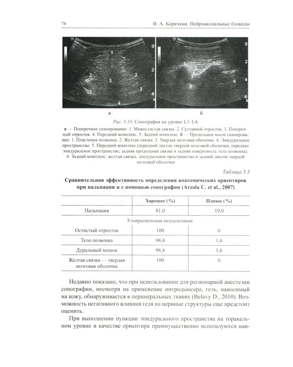 Нейроаксиальные блокады. 3-е изд