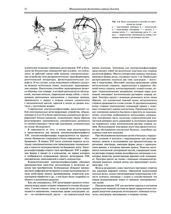 Функциональная диагностика нервных болезней: руководство для врачей. 6-е изд